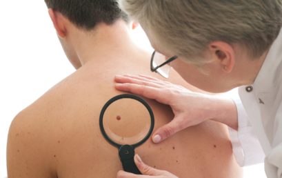 População surda recebe orientação sobre câncer de pele e cuidados com raios solares